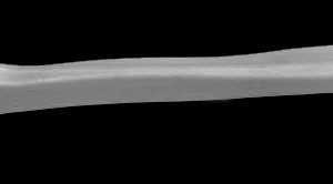 Brat suspensie roata RINGER 1141001527