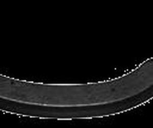 Cap de bara RINGER 1140001264 – CITROEN | AutoRival